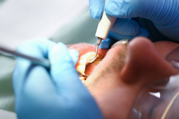 Best Same-Day Emergency Dental Services in Biltmore Forest, NC