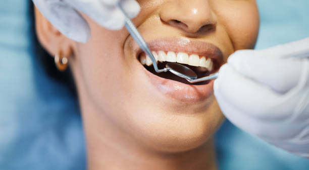 Best Urgent Care for Lost Fillings or Crowns in Biltmore Forest, NC