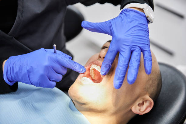Best Emergency Dental Care for Broken or Chipped Teeth in Biltmore Forest, NC